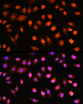 Pan-AKT antibody