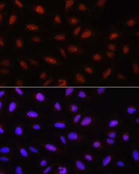 Pan-AKT antibody