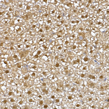 Visfatin 1 antibody