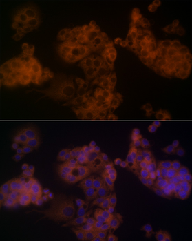 ARRB1 antibody