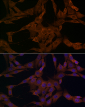 ARRB1 antibody