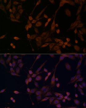 ARRB1 antibody