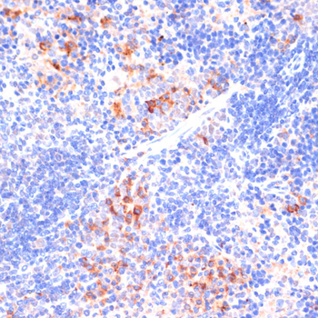 ARRB1 antibody