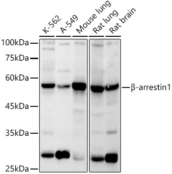 ARRB1 antibody