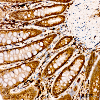 LDHA antibody