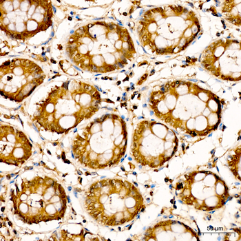 LDHA antibody