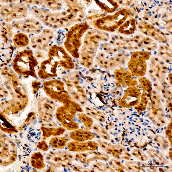 LDHA antibody