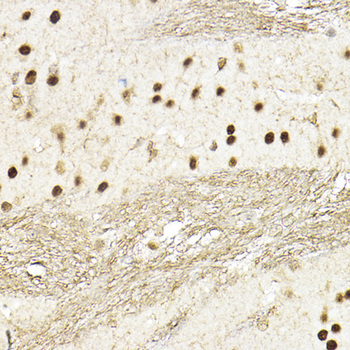 TEAD1 antibody