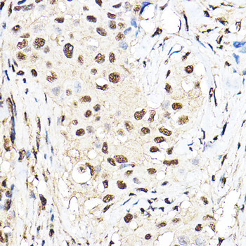 TEAD1 antibody