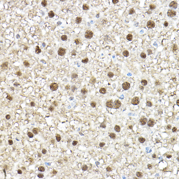 TEAD1 antibody