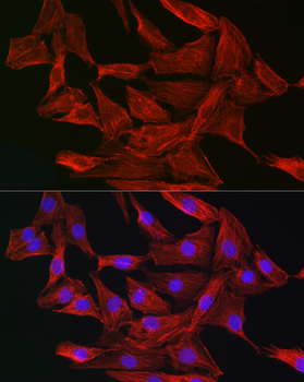 GSN antibody