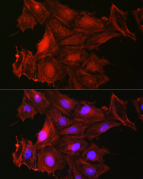 GSN antibody