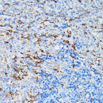 GSN antibody