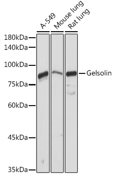 GSN antibody