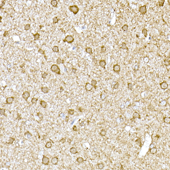 TOM20 antibody