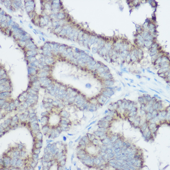 TOM20 antibody