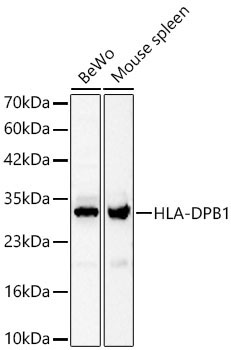 HLA-DPB1 antibody