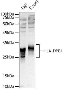 HLA-DPB1 antibody