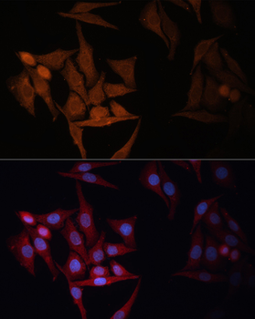 HLA-DPB1 antibody