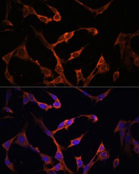 HLA-DPB1 antibody