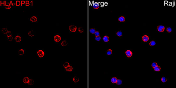 HLA-DPB1 antibody