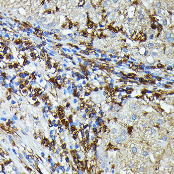 HLA-DPB1 antibody