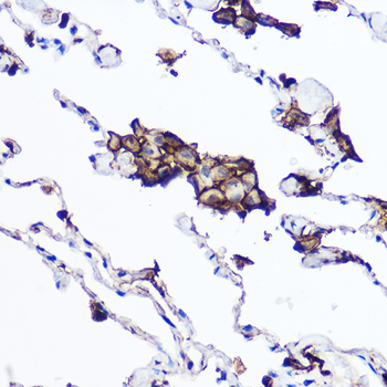 HLA-DPB1 antibody