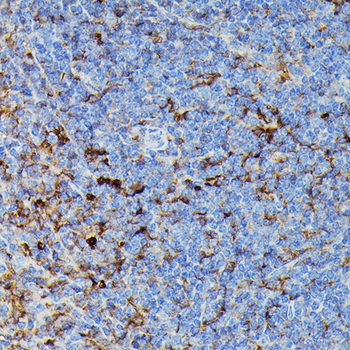 HLA-DPB1 antibody