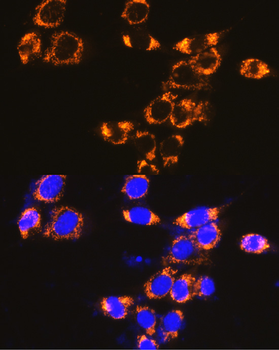 IFNAR1 antibody