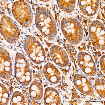 IFNAR1 antibody