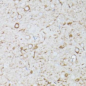 IFNAR1 antibody