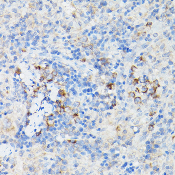 IFNAR1 antibody