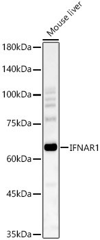 IFNAR1 antibody