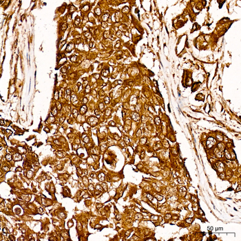 HIF1AN antibody