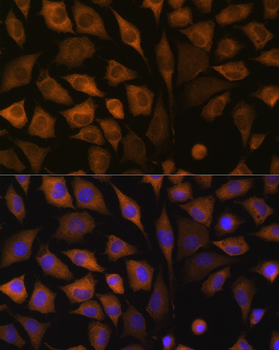 SND1 antibody