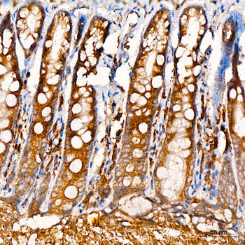 SND1 antibody