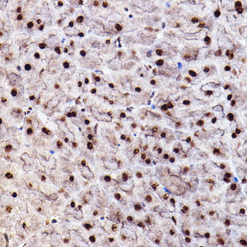 AKT1 (Phospho-S473) & AKT2-(Phospho-S474/AKT3-S472) antibody