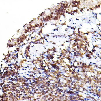 AKT1 (Phospho-S473) & AKT2-(Phospho-S474/AKT3-S472) antibody