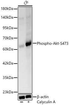 AKT1 (Phospho-S473) & AKT2-(Phospho-S474/AKT3-S472) antibody