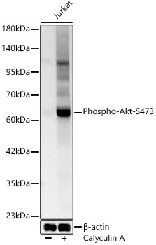 AKT1 (Phospho-S473) & AKT2-(Phospho-S474/AKT3-S472) antibody