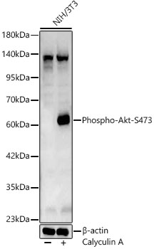 AKT1 (Phospho-S473) & AKT2-(Phospho-S474/AKT3-S472) antibody