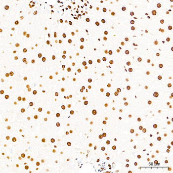 p53 (Phospho-S37) antibody