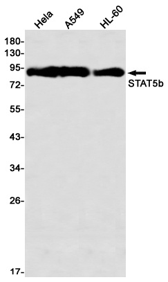 STAT5B Antibody
