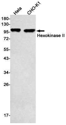 HK2 Antibody