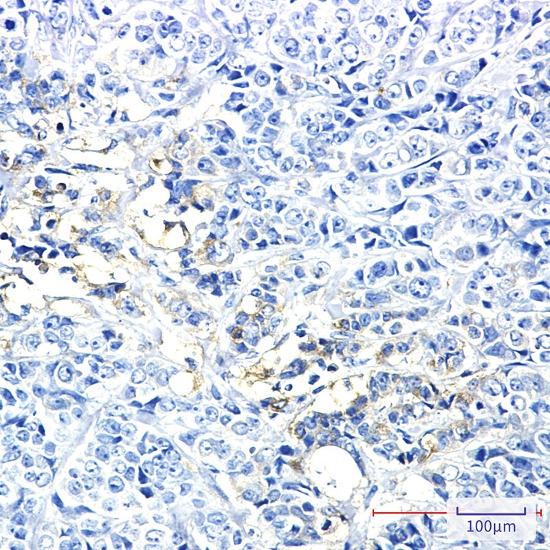 HK2 Antibody