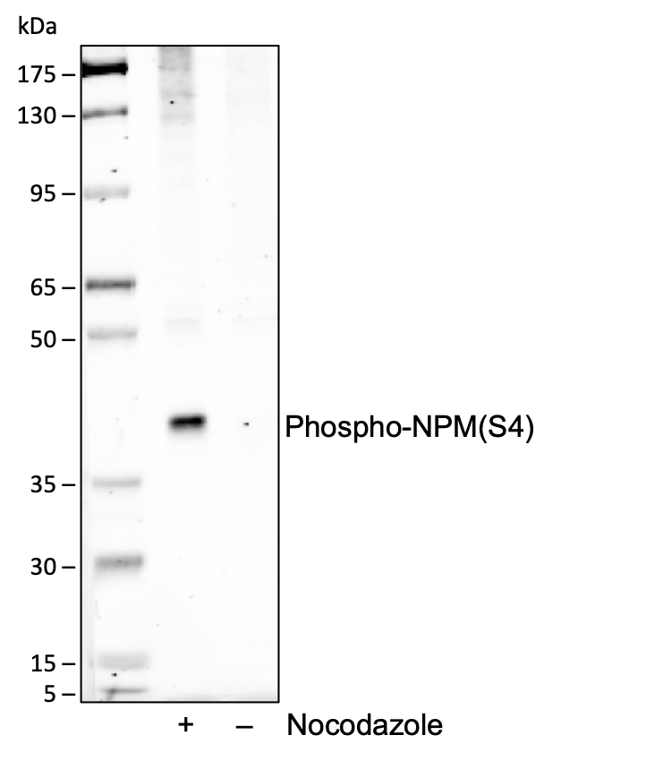 Phospho-NPM (Ser4) (A1) rabbit mAb Antibody