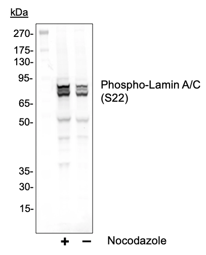 Phospho-Lamin A/C (Ser22) (CF12) rabbit mAb Antibody