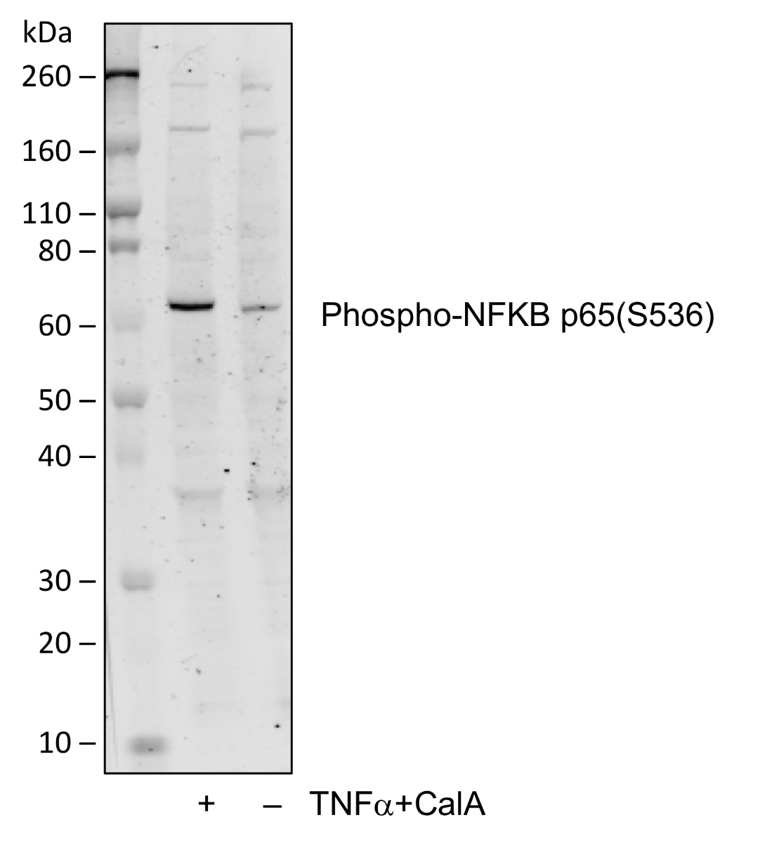 Phospho-NFKB p65 (Ser536) (B7) rabbit mAb Antibody