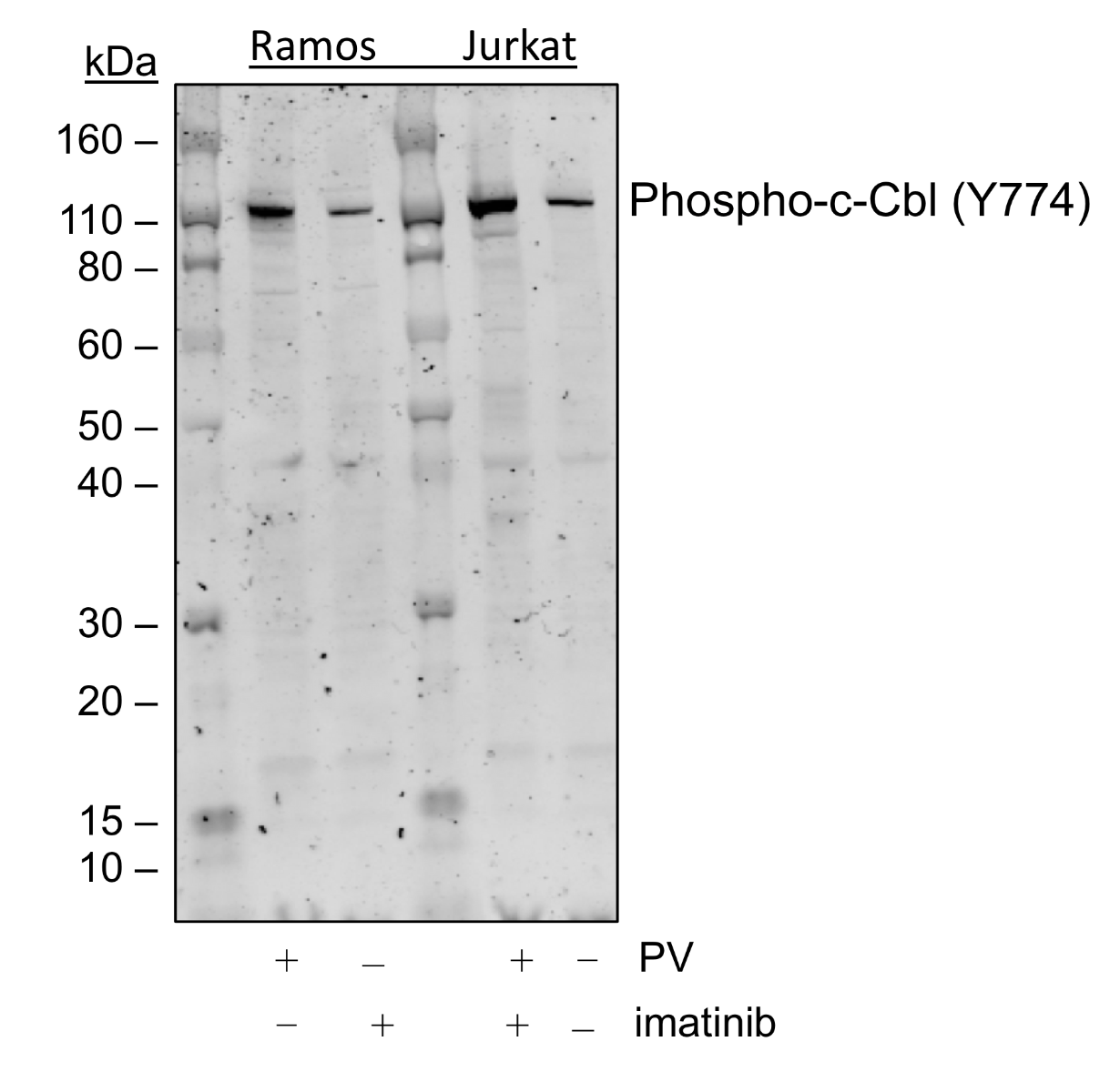 Phospho-c-Cbl (Tyr774) (R4C5) rabbit mAb Antibody