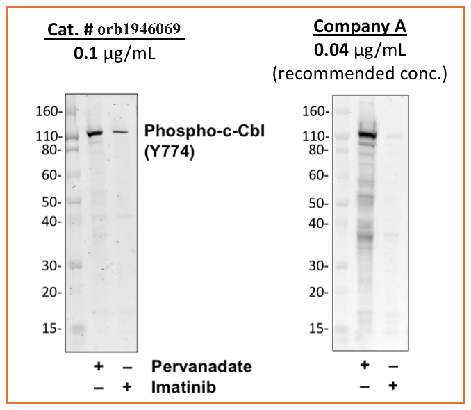 Phospho-c-Cbl (Tyr774) (R4C5) rabbit mAb Antibody